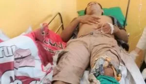 Suami Terbakar Cemburu, Kaki Terduga Pria Idaman Lain Istri Ditebas