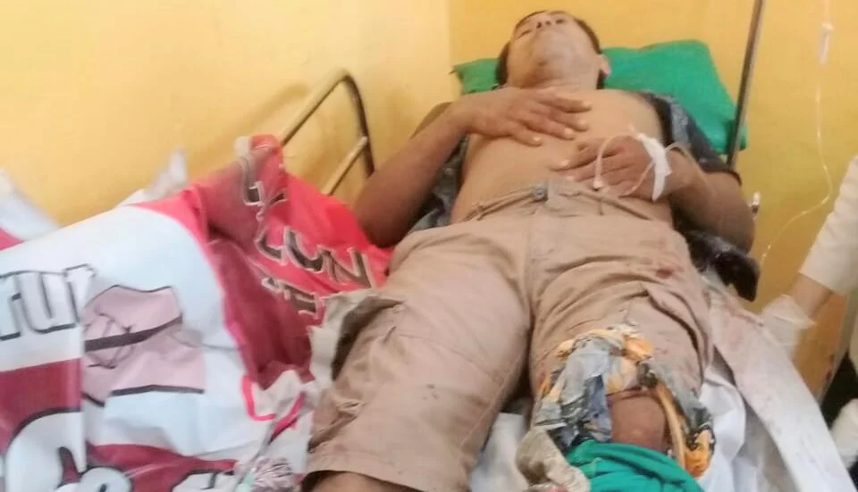 Suami Terbakar Cemburu, Kaki Terduga Pria Idaman Lain Istri Ditebas