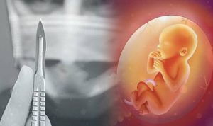 Tragis, Perempuan Ini Tewas Usai Keguguran dan Minum Pil dari Kekasih