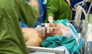 Dirut RSU Bahteramas Beber Fakta Penyebab Meninggalnya Yusuf Kardawi