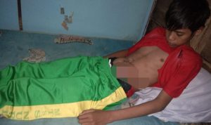 Kendala Niaya, Anak Penderita Radang Usus di Buteng Harus Jalani Perawatan di Rumah