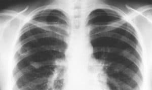 Ancam Keselamatan Warga, JATI Sultra Minta Hentikan Sementara Aktivitas PT OSS