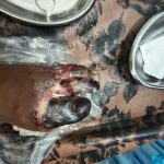 Karyawan PT SDM Kecelakaan Saat Jam Kerja, Pihak Perusahaan Tutup Mata