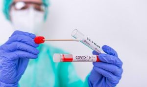 Rapid Test Antigen, Tak Ada Warga Positif Covid dalam Kerumunan Jokowi di NTT